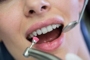 Discover how a cosmetic dentist in Lancaster, OH, can brighten your smile.