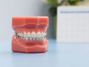 Learn where to find Six Month Smiles in Lancaster, OH