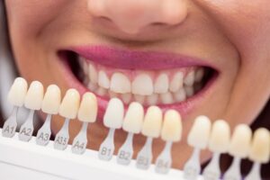 Learn how composite veneers in Lancaster can transform your smile